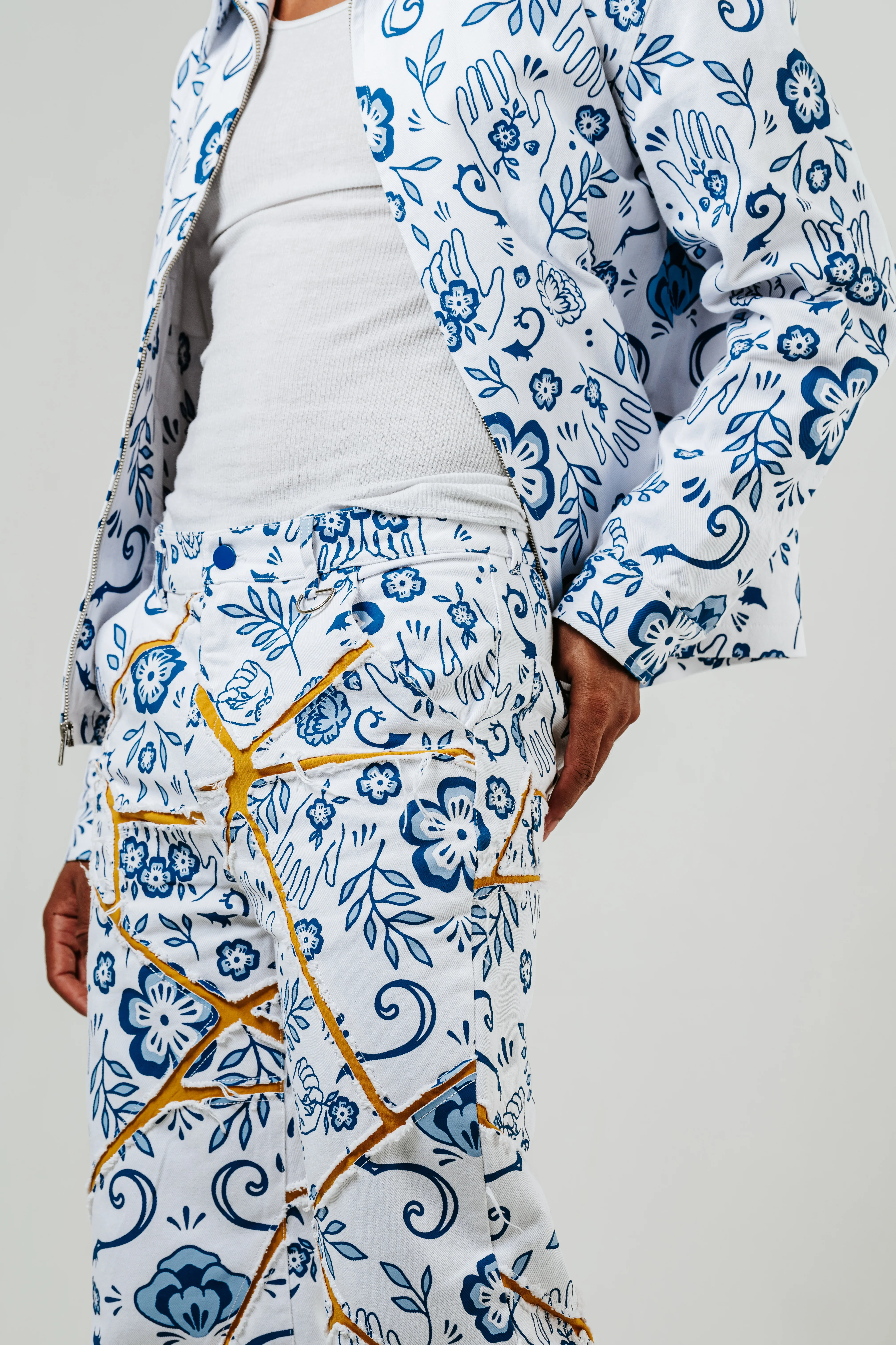 Porcelain Jacket - Image 5